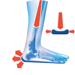 Heel shock diagram